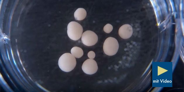 Gehirn-Organoide in einer Petri-Schale im Labor. Copyright: UC San Diego Health Sciences