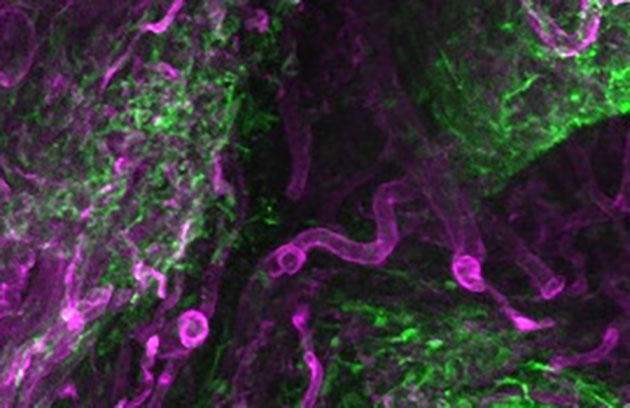 Faszienzellen (grün), die mit ihrer umliegenden Matrix (magenta) zu den offenen Hautwunden wandern. Chimäre Transplantate zur Untersuchung des Einflusses der subkutanen Faszie (rot) und der Hautzellen (grün) während des Wundheilungs-/Narbenprozesses. Copyright: Helmholtz Zentrum München / Donovan Correa Gallegos