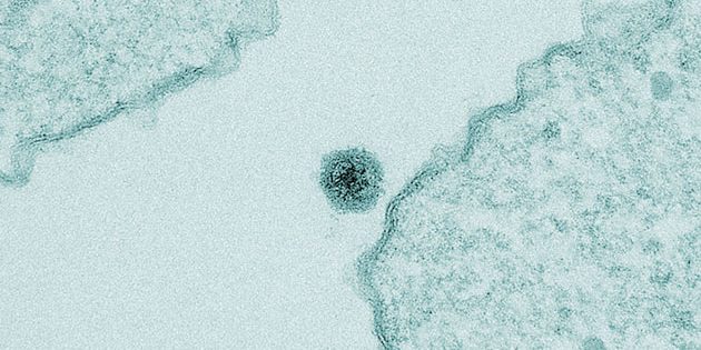 Mikroskopaufnahme des neuentdeckten "Yaravirus". Copyright: IHU Aix Marseille University and Microscopy Center/UFMG