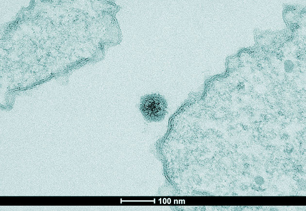 Mikroskopaufnahme des neuentdeckten "Yaravirus". Copyright: IHU Aix Marseille University and Microscopy Center/UFMG