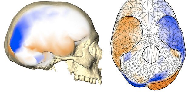 Das gemeinsame Asymmetriemuster des Gehirns wird an einem menschlichen Endocast (Abguss des inneren knöchernen Gehirnschädels) von der Seite (links) und von unten (rechts) gezeigt. Dieses Muster umfasst eine stärker nach hinten ragende linke Gehirnhälfte und eine stärker nach vorne ragende rechte Gehirnhälfte mit lokalisierten größeren Oberflächenbereichen (orange) auf einer Gehirnhälfte im Vergleich zu entsprechenden kleineren Bereichen (blau) auf der anderen Hemisphäre. Es beinhaltet auch unterschiedliche Projektionen der Kleinhirnhälften und der Schläfenlappenpole. Copyright: Simon Neubauer, CC BY-NC-ND 4.0
