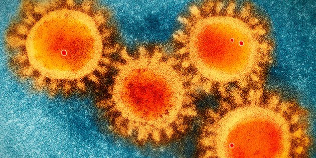 Das Coronavirus SARS-CoV-2 (COVID-19) unter dem Elektronenmikroskop. Copyright/Quelle: Scrips Research Institute