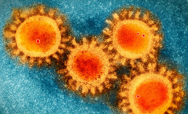 Das Coronavirus SARS-CoV-2 (COVID-19) unter dem Elektronenmikroskop. Copyright/Quelle: Scrips Research Institute