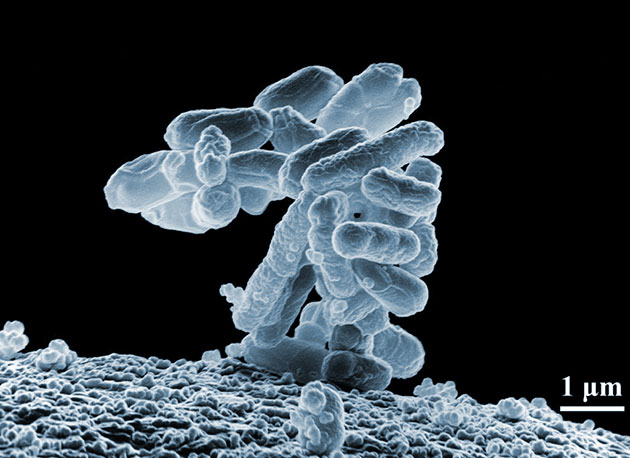 Escherichia coli-Bakterien unter dem Elektronenmikroskop. Copyright: Gemeinfrei