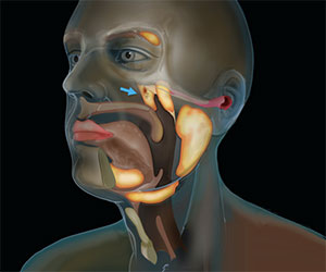 Anatomische Darstellung der beiden „neuen“ Speicheldrüsen hinter dem Nasenrachenraum (Illu.). Quelle: Valstar et al., Radiotherapy and Oncology, 2020 / Netherlands Cancer Institute