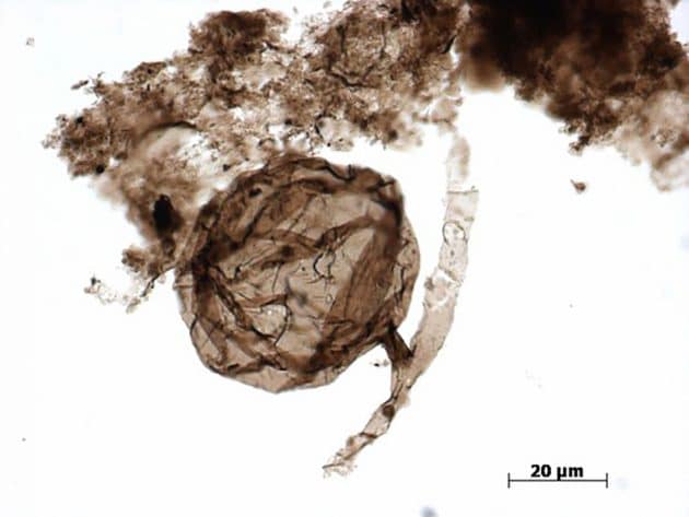 Mikroskopaufnahme der 900 Mio. bis 1 Mrd. Jahre alten Mikrofossilien aus der Grassy Bay Formation. Copyright: C. Loron / Handout Laurentian University