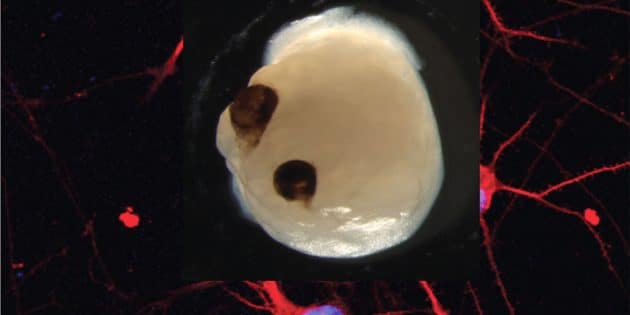 Deutlich sichtbar: Jay Gopalakrishnan und Team gelang es, augenähnliche Strukturen auf einem 2 - 2,5 mm großen Hirn-Organoid aus Stammzellen zu erzeugen. Copyright: J. Gopalakrishnan