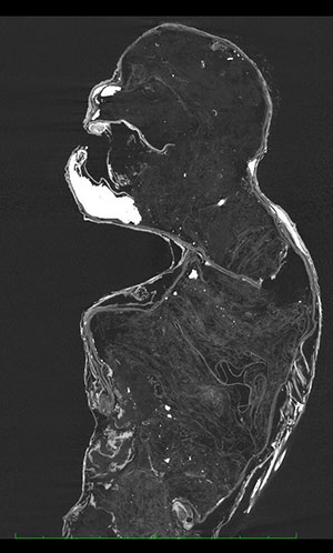 Röntgenaufnahme der Mumie.Copyright: www.kusa.ac.jp