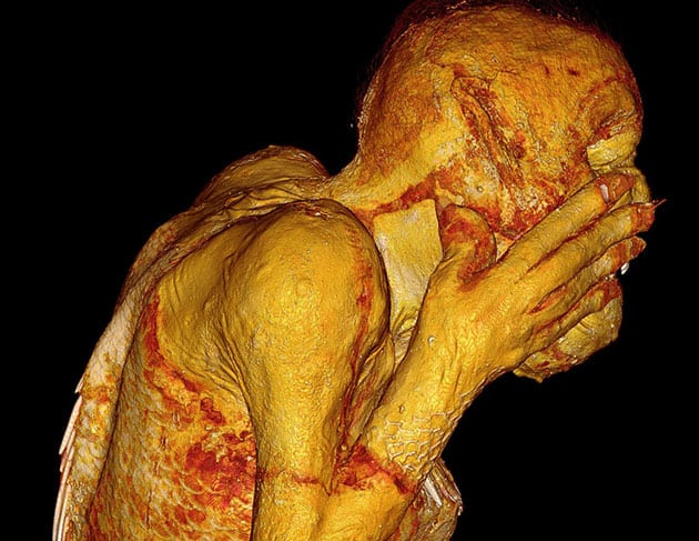 CT-Scan der Amabie-Mumie.Copyright: www.kusa.ac.jp