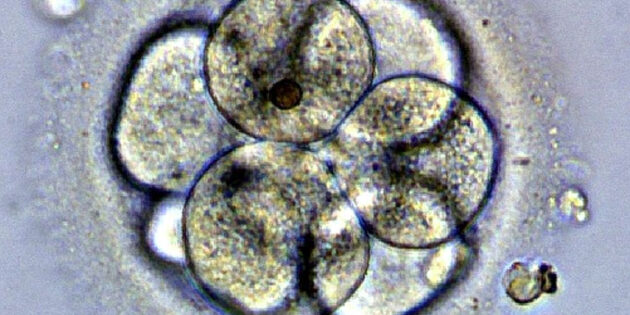 Symbolbild: Embryonale Entwicklung. Copyright: Nina Sesina (via Wikimediacommons) / CC BY-SA 4.0